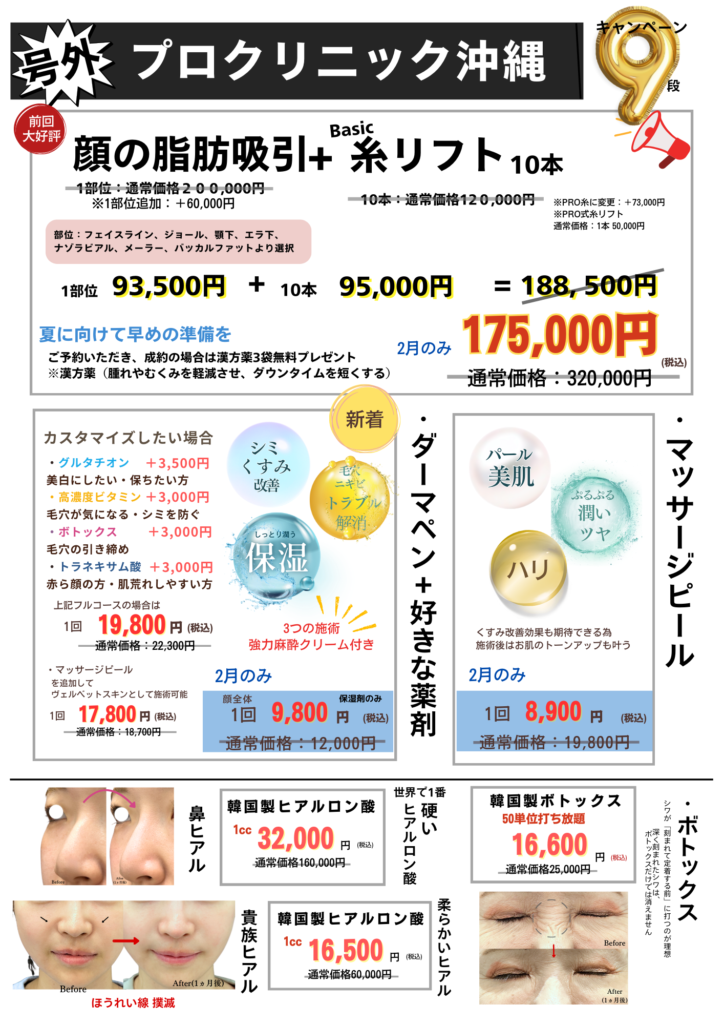 【2月限定】小顔・美肌を叶える特別プラン。顔の脂肪吸引セットや肌質改善メニューが大幅プライスダウン。