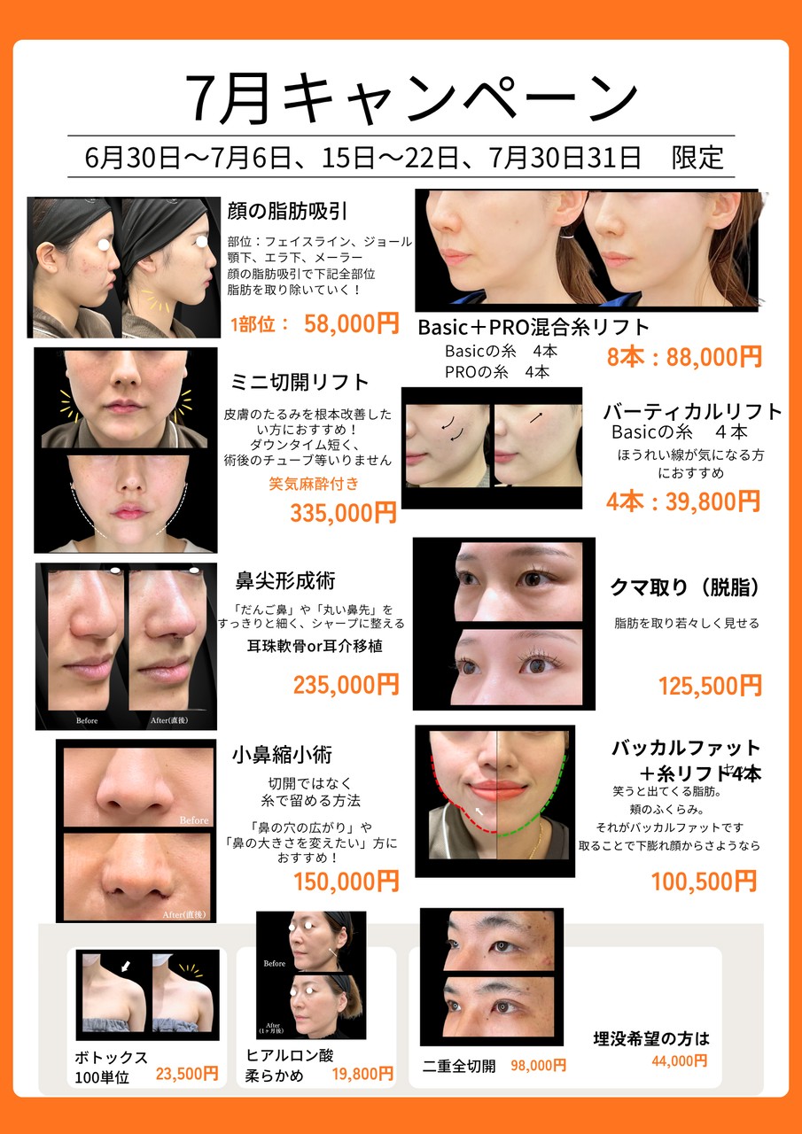 PRO CLINIC沖縄 2026年7月限定キャンペーン。顔の脂肪吸引、糸リフト、鼻尖形成、小鼻縮小、クマ取り、二重整形、ボトックス、ヒアルロン酸を特別価格で案内。